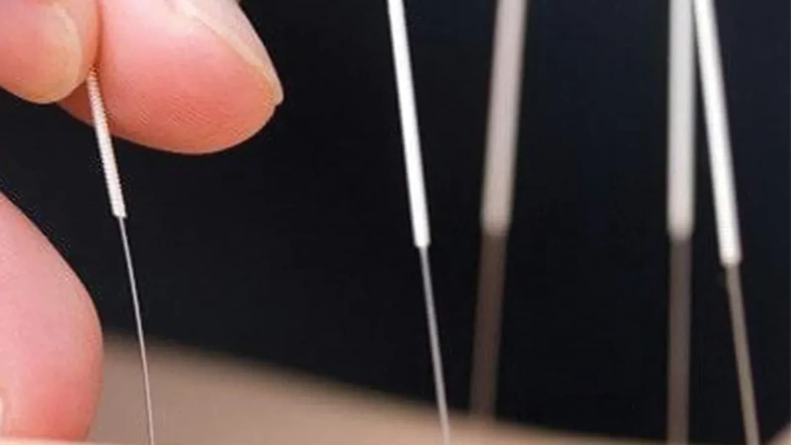 تصویر بخش کلینیک طب سوزنی