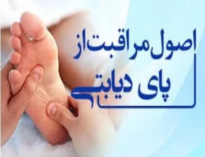 اصول مراقبت از پای دیابتی